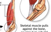 How Exercise Helps Bones