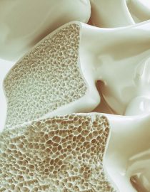 Five Osteoporosis Risk Factors to Be Aware Of Five Osteoporosis Risk Factors to Be Aware Of