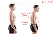 Osteoporosis and Kyphosis